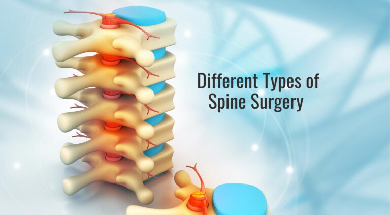Different Types of Spine Surgery