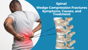 Spinal Wedge Compression Fractures - Dr. Akhil Tawari