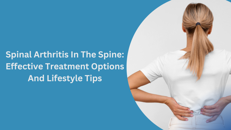 spinal arthritis treatment